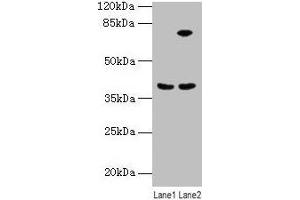 Western blot All lanes: ANXA9 antibody at 8 μg/mL Lane 1: Mouse kidney tissue Lane 2: A431 whole cell lysate Secondary Goat polyclonal to rabbit IgG at 1/10000 dilution Predicted band size: 39 kDa Observed band size: 39 kDa (Annexin A9 Antikörper  (AA 8-345))