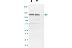 Western blot anyalysis of Lane 1: NIH-3T3 cell lysate (Mouse embryonic fibroblast cells), Lane 2: NBT-II cell lysate (Rat Wistar bladder tumour cells), Lane 3: PC12 cell lysate (Pheochromocytoma of rat adrenal medulla) with NCAPH polyclonal antibody . (NCAPH Antikörper)