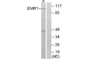 Western blot analysis of extracts from Jurkat cells, using EMR1 antibody. (F4/80 Antikörper  (C-Term))