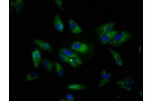 Immunofluorescence staining of Hela cells with ABIN7169553 at 1:133, counter-stained with DAPI. (Sialoadhesin/CD169 Antikörper  (AA 572-697))