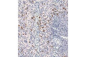 Immunohistochemical analysis of (ABIN1537232 and ABIN2838268) on paraffin-embedded human spleen tissue was performed on the Leica®BOND RXm. (DEFa3 Antikörper  (C-Term))
