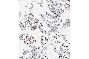 Immunohistochemistry (Paraffin-embedded Sections) (IHC (p)) image for anti-ADAM Metallopeptidase with thrombospondin Type 1 Motif, 17 (ADAMTS17) (AA 508-540) antibody (ABIN6243834)
