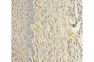 Immunohistochemistry of paraffin-embedded human tonsil tissue using ABIN7176084 at dilution of 1:100 (ZMAT5 Antikörper  (AA 1-170))