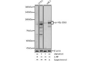 Western blot analysis of extracts of various cell lines, using Phospho-HSL-S563 antibody (ABIN7268278) at 1:1000 dilution. (LIPE Antikörper  (pSer563))