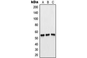 Western blot analysis of PFKFB1/4 expression in Jurkat (A), H1299 (B), HeLa (C) whole cell lysates. (PFKFB1/4 Antikörper  (Center))