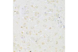 Immunohistochemistry of paraffin-embedded mouse brain using CHRNA7 antibody (ABIN4903285) at dilution of 1:100 (40x lens). (CHRNA7 Antikörper)