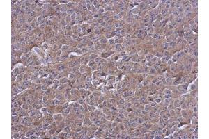 IHC-P Image Immunohistochemical analysis of paraffin-embedded D54 xenograft, using PTPN12, antibody at 1:500 dilution.