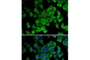 Immunofluorescence analysis of MCF7 cells using PPL Polyclonal Antibody (PPL Antikörper)