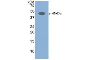 Detection of Recombinant DSG3, Human using Polyclonal Antibody to Desmoglein 3 (DSG3) (Desmoglein 3 Antikörper  (AA 858-999))