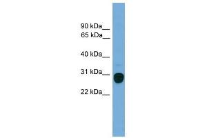 TREM2 antibody used at 1 ug/ml to detect target protein. (TREM2 Antikörper  (Middle Region))