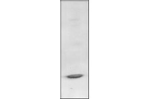 Western Blotting (WB) image for anti-B-Cell CLL/lymphoma 3 (BCL3) antibody (ABIN950631) (BCL3 Antikörper)