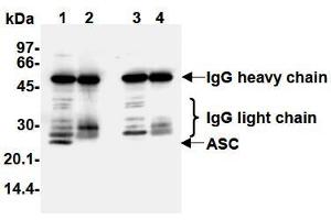 Western Blotting (WB) image for anti-PYD and CARD Domain Containing (PYCARD) antibody (ABIN1105662)