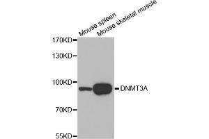 Western blot analysis of extracts of various cell lines, using DNMT3A antibody (ABIN1872325). (DNMT3A Antikörper)