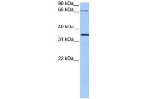 NLGN4X antibody used at 1 ug/ml to detect target protein. (Neuroligin 4 Antikörper  (N-Term))