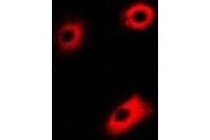 Immunofluorescent analysis of DLD staining in U2OS cells. (DLD Antikörper)
