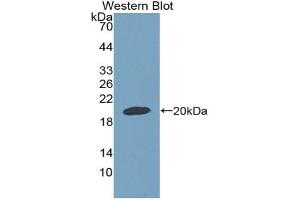 Detection of Recombinant GDF9, Rat using Polyclonal Antibody to Growth Differentiation Factor 9 (GDF9) (GDF9 Antikörper  (AA 306-440))