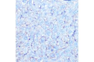 Immunohistochemistry of paraffin-embedded mouse liver using Na+/K+-ATPase Rabbit mAb (ABIN7270390) at dilution of 1:100 (40x lens). (ATP1A1 Antikörper)