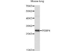 Western blot analysis of extracts of mouse lung, using PEBP4 antibody (ABIN6293825) at 1:1000 dilution. (PEBP4 Antikörper)