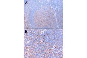 Image no. 2 for anti-GATA Binding Protein 3 (GATA3) (N-Term) antibody (ABIN401530) (GATA3 Antikörper  (N-Term))