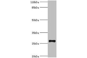 Western blot All lanes: TSPAN6 antibody at 20 μg/mL + Mouse liver tissue Secondary Goat polyclonal to rabbit IgG at 1/10000 dilution Predicted band size: 28 kDa Observed band size: 28 kDa (Tetraspanin 6 Antikörper  (AA 115-208))
