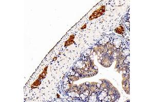 Immunohistochemistry (Paraffin-embedded Sections) (IHC (p)) image for anti-Peripherin (PRPH) antibody (ABIN7075012)