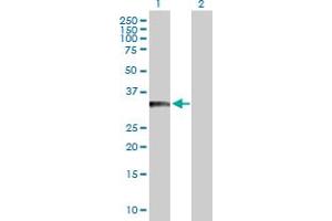 Western Blot analysis of BCL11A expression in transfected 293T cell line by BCL11A MaxPab polyclonal antibody. (BCL11A Antikörper  (AA 1-243))