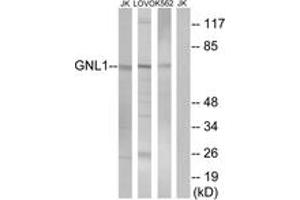 Western blot analysis of extracts from Jurkat/LOVO/K562 cells, using GNL1 Antibody. (GNL1 Antikörper  (AA 61-110))