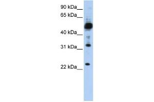 WB Suggested Anti-TMEM38B Antibody Titration:  0. (TMEM38B Antikörper  (C-Term))