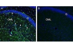 Expression of Secretin Receptor in rat hippocampusImmunohistochemical staining of perfusion-fixed frozen rat brain sections with Anti-Secretin Receptor (extracellular) Antibody (ABIN7043607, ABIN7044414 and ABIN7044415), (1:200), followed by goat anti-rabbit-AlexaFluor-488. (Secretin Receptor (SCTR) Peptid)