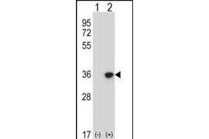 Western blot analysis of DLX4 (arrow) using rabbit polyclonal DLX4 Antibody (Center) (ABIN657967 and ABIN2846913). (DLX4 Antikörper  (AA 72-100))
