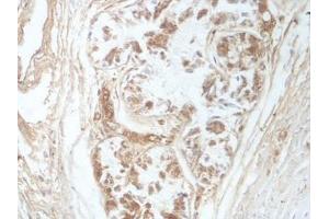 IHC analysis of formalin-fixed paraffin-embedded fetal bronchus, using SUN1 antibody (1/100 dilution). (SUN1 Antikörper  (AA 22-173))