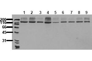 Western Blotting (WB) image for anti-RAPTOR (RAPTOR) antibody (ABIN492625) (RAPTOR Antikörper)