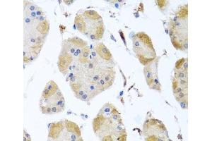Immunohistochemistry of paraffin-embedded Human stomach using MYLK Polyclonal Antibody at dilution of 1:100 (40x lens). (MYLK Antikörper)