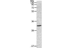 Western blot analysis of 293T cell, using MMP26 Polyclonal Antibody at dilution of 1:500 (MMP26 Antikörper)