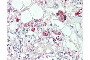 Human Thymus: Formalin-Fixed, Paraffin-Embedded (FFPE), at a concentration of 5 ug/ml. (CCR6 Antikörper  (AA 18-46))
