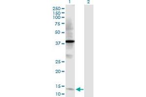 Western Blot analysis of TFF2 expression in transfected 293T cell line by TFF2 MaxPab polyclonal antibody.