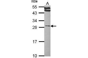 WB Image Sample (30 ug of whole cell lysate) A: Hep G2 , 12% SDS PAGE RALA antibody antibody diluted at 1:1000