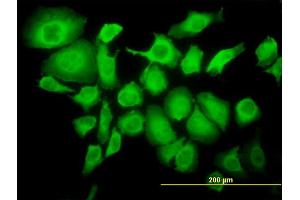 Immunofluorescence of monoclonal antibody to TRIM25 on HeLa cell. (TRIM25 Antikörper  (AA 211-310))