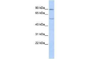 Western Blotting (WB) image for anti-Cadherin 4 (CDH4) antibody (ABIN2458919) (Cadherin 4 Antikörper)