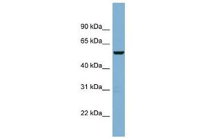 C2ORF29 antibody used at 1 ug/ml to detect target protein. (CNOT11 Antikörper  (Middle Region))