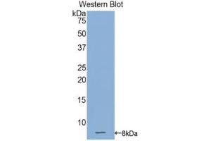 Western blot analysis of the recombinant protein. (Connexin 31 Antikörper  (AA 211-269))