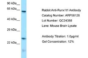 Western Blotting (WB) image for anti-Runt-Related Transcription Factor 1, Translocated To, 1 (Cyclin D-Related) (RUNX1T1) (N-Term) antibody (ABIN971644) (RUNX1T1 Antikörper  (N-Term))