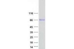 Western Blotting (WB) image for Collagen, Type XXIII, alpha 1 (COL23A1) protein (Myc-DYKDDDDK Tag) (ABIN2712434)