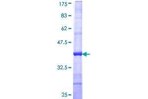 Image no. 1 for Keratocan (KERA) (AA 253-351) protein (GST tag) (ABIN1308536) (KERA Protein (AA 253-351) (GST tag))