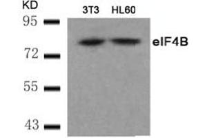 Image no. 2 for anti-Eukaryotic Translation Initiation Factor 4B (EIF4B) (AA 420-424) antibody (ABIN401568) (EIF4B Antikörper  (AA 420-424))