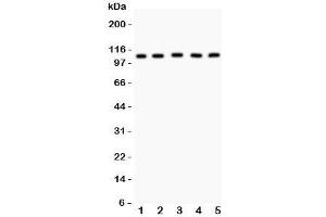 Western blot testing of MSH2 antibody and Lane 1:  mouse testis;  2: (m) skeletal muscle;  3: human HeLa;  4: (h) A549;  5: (h) SMMC-7721 lysate. (MSH2 Antikörper  (AA 337-583))