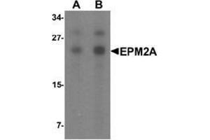 Western blot analysis of SW480 in SW480 cell lysate with EPM2A Antibody  at (A) 1 and (B) 2 μg/ml. (EPM2A Antikörper  (C-Term))