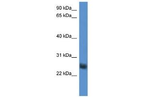 WB Suggested Anti-SLA2 Antibody Titration: 0. (SLAP2 Antikörper  (Middle Region))