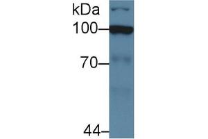 Western Blot; Sample: Human Jurkat cell lysate; Primary Ab: 5µg/ml Rabbit Anti-Human HK2 Antibody Second Ab: 0.