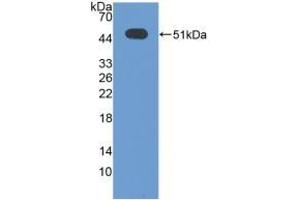 Detection of Recombinant ATF3, Human using Polyclonal Antibody to Activating Transcription Factor 3 (ATF3) (ATF3 Antikörper  (AA 1-181))